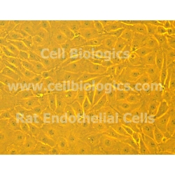 ZDF Rat Diabetic Cardiac Microvascular Endothelial Cells